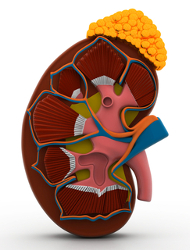 Avella Selected by Otsuka to distribute Jynarque