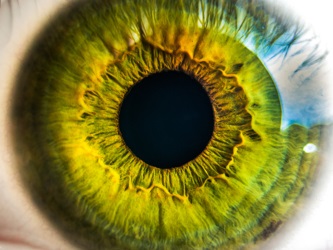 wet AMD (age-related macular degeneration)
