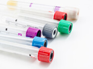 Pharmaceutical Biomarker Testing and Services