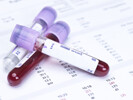 Pharmaceutical Hematology Testing Services