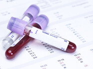 Pharmaceutical Hematology Testing Services
