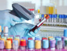 Pharmaceutical Immunology Laboratory Testing Services