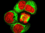 Stable Cell Line Development / Cell Line Services